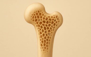 پوکی استخوان